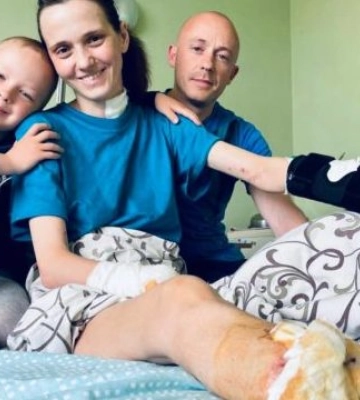 Дивом вижила, але втратила руку, ногу та дитину, яку носила під серцем. Історія Катерини з Донеччини