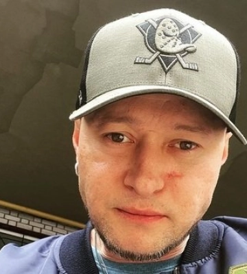 Андрей Хлывнюк выставит на аукцион осколок, ранивший его лицо