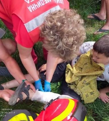 Повезли в лікарню з частиною паркану: на Дніпропетровщині рятувальники допомогли дитині