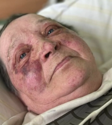 В Херсоне россияне сломали позвоночник 70-летней журналистке из-за отказа сдать украинский паспорт