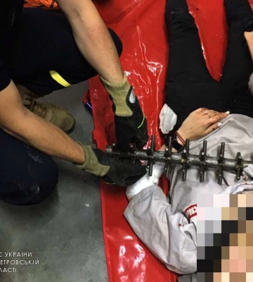 Викликали рятувальників: у Дніпрі рука жінки застрягла в станку для виготовлення кондитерських виробів (Фото)