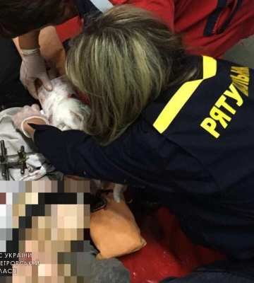 В Днепре на производстве женщина застряла в станке: пострадавшая в больнице (фото 18+)