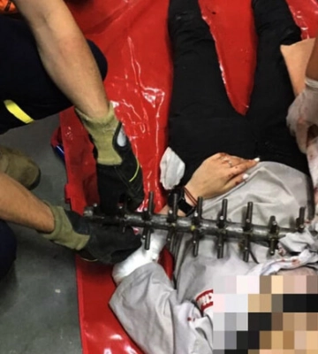 У Дніпрі жінка застрягла у станку з виробництва солодощів
