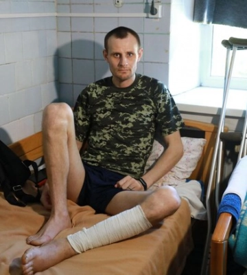 Боєць &quot;Азова&quot;, який лікується у Запоріжжі, розповів про перебування у полоні