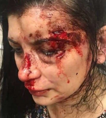 У Дніпрі суд розглядає справу про напад на активістку Наталію Ешонкулову: що розповіли свідки