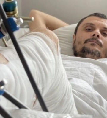 Не допустили ампутації: у Львові успішно провели унікальне лікування складного перелому гомілки