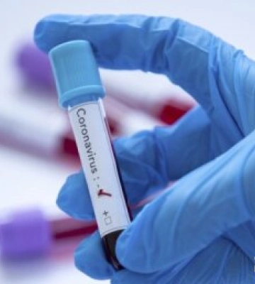 У Бердичеві рівень захворюванності на COVID-19 перевіщує середньобласний