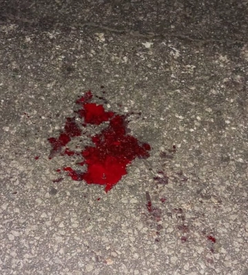Полиция в Харькове возбудила уголовное дело из-за наезда на пешехода