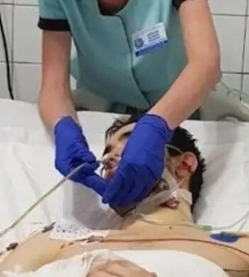 У Дніпрі лікарі врятували 20-річного військового з уламком у сонній артерії