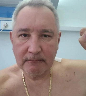 Рогозін надіслав послу Франції осколок снаряда, який витягли з його хребта. Каже, що від САУ Caesar