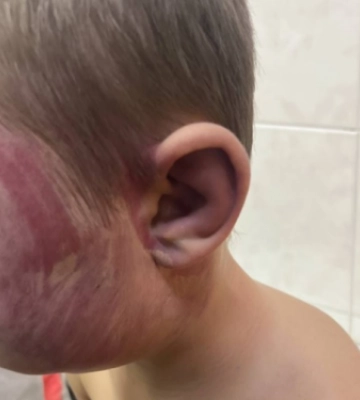 Мешканцю Запорізького району, який жорстоко побив свого маленького сина, повідомили про підозру