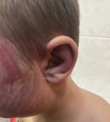 В Запорожье мужчина жестоко избил сына: ребенка госпитализировали