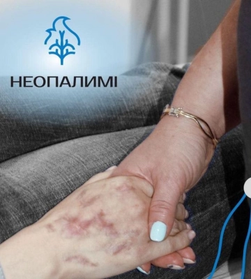 Мешканці Рівненщини, які отримали опіки, пройдуть безоплатне лікування опіків та рубців