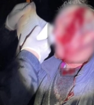 В Ужгороді психічнохворий син побив власного батька
