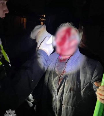 В Ужгороді психічнохворий син побив власного батька