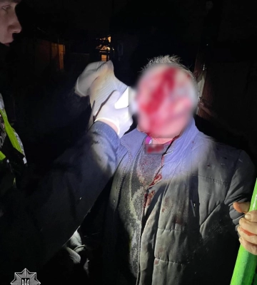 В Ужгороді психічнохворий чоловік побив батька 