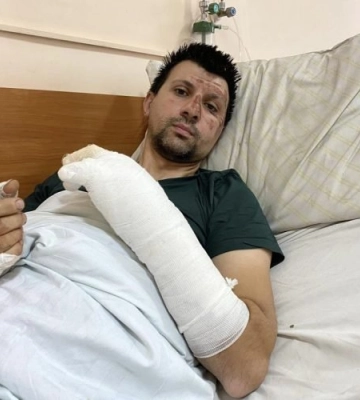 Історія постраждалого львів&#039;янина, у якого вибухнув акумулятор у квартирі, - ФОТО