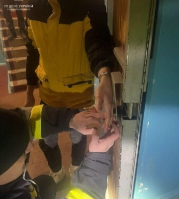 У Житомирі руку 15-річного хлопця затисло у замку вхідних дверей