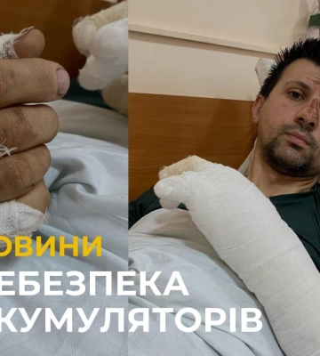 У Львові чоловік постраждав внаслідок вибуху акумулятора у квартирі (відео)