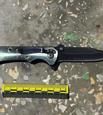 У Кривому Розі п&#039;яний чоловік встромив ніж у око супернику і відкусив йому ніс