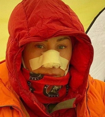 Дружина Філатова розповіла, як мало не залишилася без носа під час походу в гори