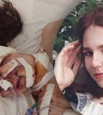 &quot;Я теряю время&quot;: 19-летняя девушка потеряла глаз во время удара России по Днепру и просит помочь