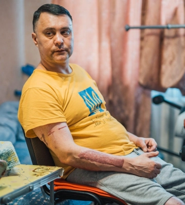 Маріуполець з опіками від фосфорних бомб потребує допомоги полтавців