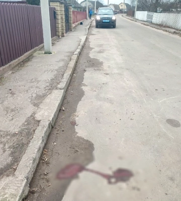 У селі на Рівненщині внаслідок ДТП травмувався 16-річний мотоцикліст