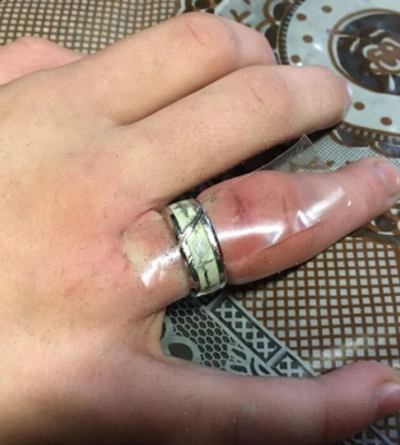 У Дніпрі надзвичайники допомогли підлітку зняти каблучку з пальця