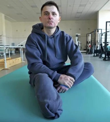 &quot;У мене ще все попереду. Це не кінець&quot;: як тяжкопоранені українські бійці проходять реабілітацію
