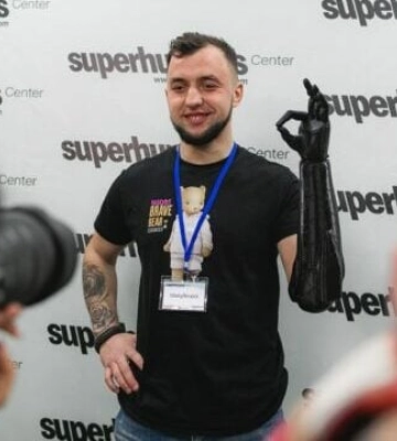 Британський інженер привіз протези для перших пацієнтів Superhumans Center