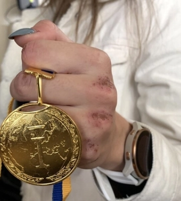 «Було доволі небезпечно»: волинські лижники про перемогу на чемпіонаті України 