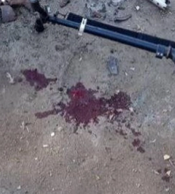 Через детонацію снаряду у селі на Миколаївщині травмувалася дитина
