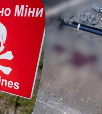 Чоловік приніс знайдений снаряд до подвір&amp;#039;я: він здетонував та поранив дитину