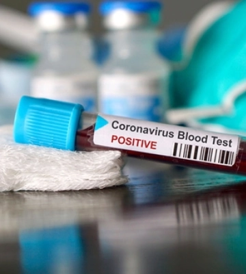 На Волині за тиждень виявили 465 нових хворих на COVID-19, двоє людей померли