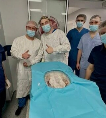Печінка жила в апараті п’ять годин: у Львові успішно пересадили орган 40-річному пацієнту