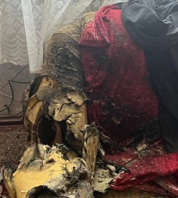 На Фастівщині 21-річний хлопець приніс гранату додому та ледь не загинув