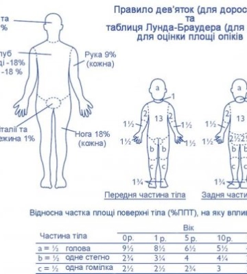 В Закарпатті щодня на лінію «103» надходять виклики від пацієнтів або їх родичів з проханням терміново надіслати «швидку» через&amp;hellip;