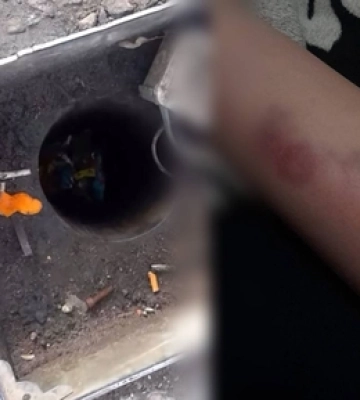 У центрі Луцька – глибоке провалля: травмувалась дитина (відео)