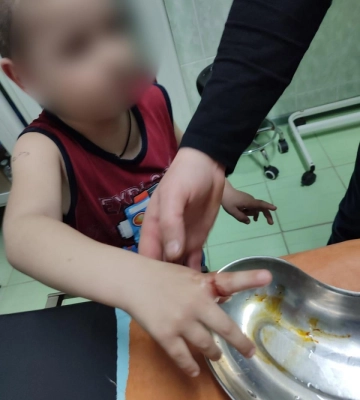 У Дубні з металевої пастки рятували палець дитини (ФОТО)