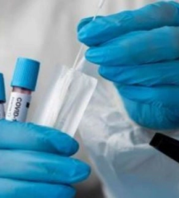 За тиждень на Київщині зареєстрували майже 1000 нових випадків захворювання на COVID-19