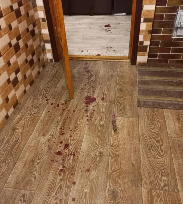 На Сарненщині поліцейські затримали чоловіка за вбивство вагітної дружини