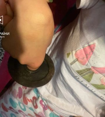 У Львові дитина вдягнула на палець кільце від гирі: викликали рятувальників