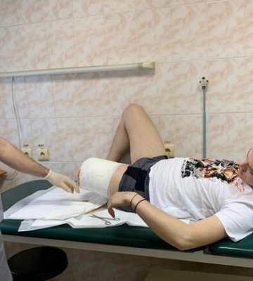 У Дніпрі врятували бійця, який втратив ногу через пряме влучання танка