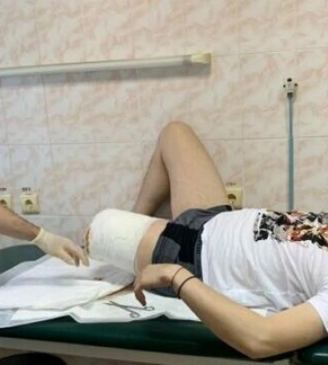 Хотів стати чемпіоном з веслування: у Дніпрі лікують воїна з травматично ампутованою ногою