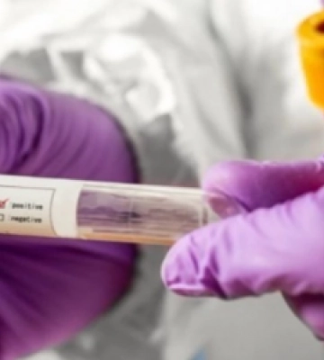 За тиждень захворюваність на COVID-19 у Львівській області знизилась на 38%