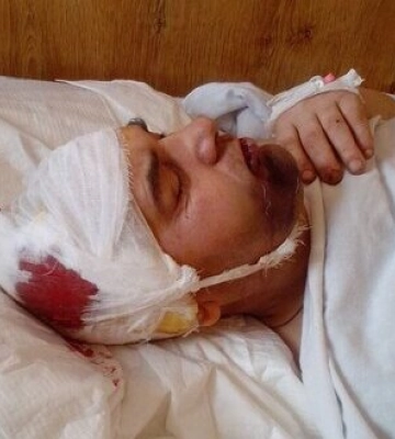 Офіцер на Волині жорстоко побив солдата. Той в лікарні: відмовили ноги. ВІДЕО+ФОТО