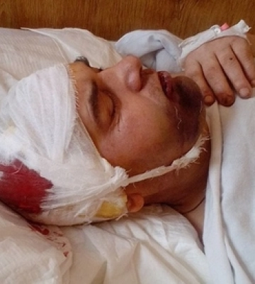 Побиття солдата на Волині: що кажуть потерпілий та офіцер, якого звинувачують (відео)