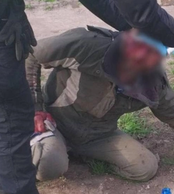 На вулиці Полтави знайшли скривавленого чоловіка