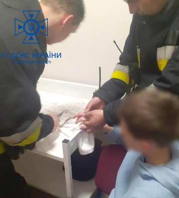 У Львові лікарі викликали рятувальників зняти каблучку з набряклого пальця дитини, - ФОТО